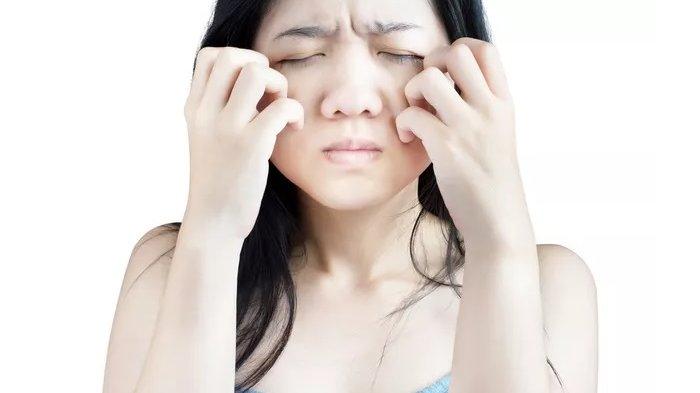 lustrasi wanita dengan masalah dermatitis atopik