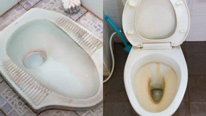 Kerak di lubang kloset bisa diatasi dengan berbagai cara sederhana.