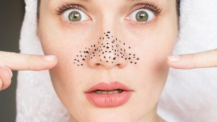 Memiliki komedo pada area hidung berfungsi bisa membuat penampilan menjadi kurang menarik.