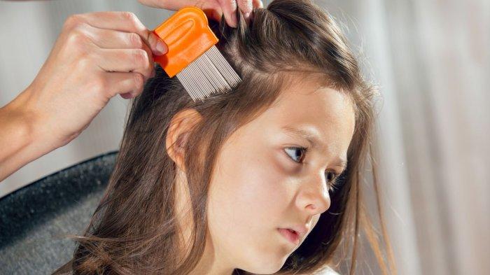Kutu rambut yang membandel bisa diatasi dengan menggunakan minyak lavender.