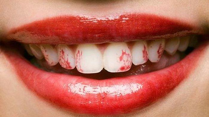 Ilustrasi lipstik jadi mudah luntur karena lupa menghapus lip balm.