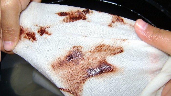 Noda getah pisang pada baju memang susah dihilangkan, karena itu perlu mencucinya dengan ekstra agar noda mudah hilang.
