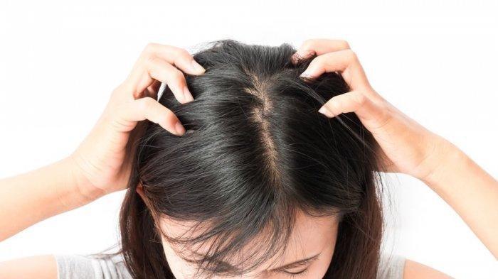 Rambut semakin tipis