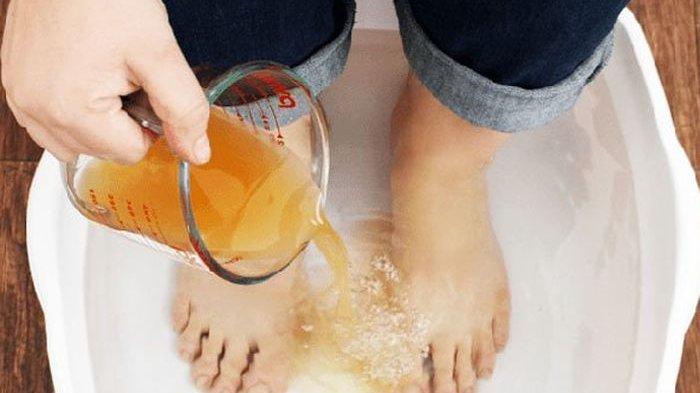 Merendam kaki di air yang dicampur cuka apel.