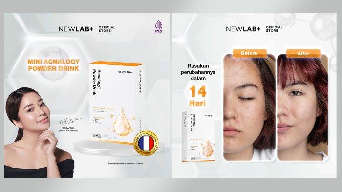 NEWLAB Acnalogy Powder Drink
