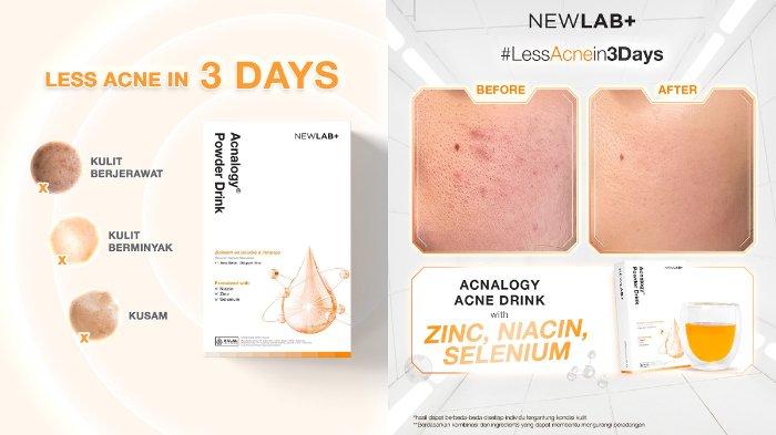 NEWLAB Acnalogy Powder Drink 5
