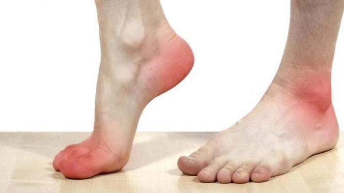 Penderita diabetes yang rawan amputasi kaki.