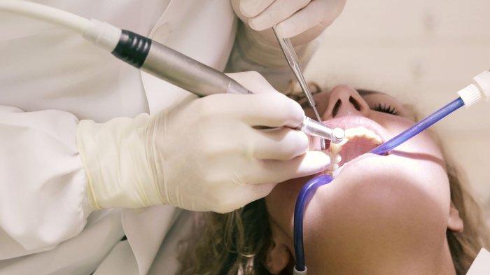 Ilustrasi Perawatan Saluran Akar Gigi.