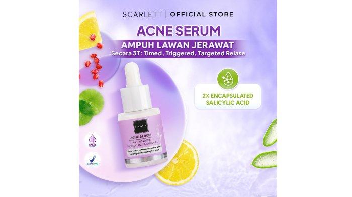 Scarlett Whitening Acne Serum 15 ml.