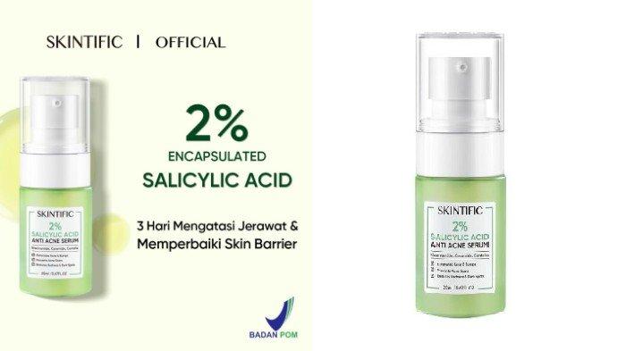 Anti Acne Serum: Kecantikan Tanpa Jerawat dengan Perawatan yang Tepat 