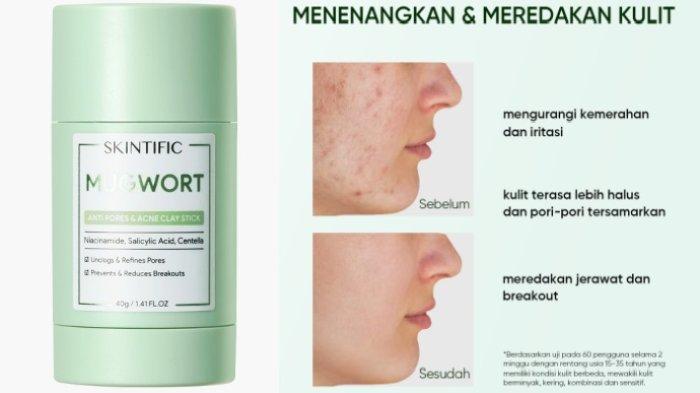 SKINTIFIC Mugwort Acne Clay Stick