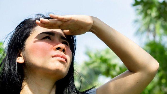 Ilustrasi kulit sunburn karena terpapar sinar matahari yang menyengat.