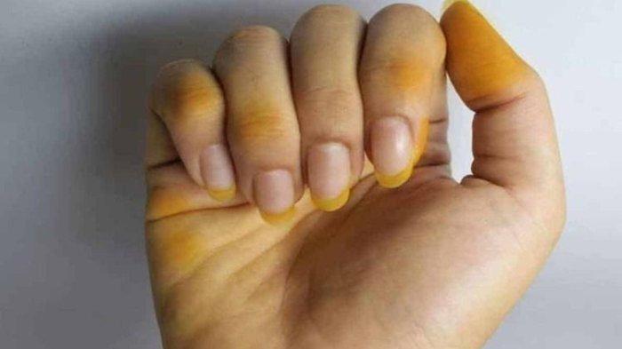 Tangan dan kuku jadi kuning gara-gara mengupas kunyit.