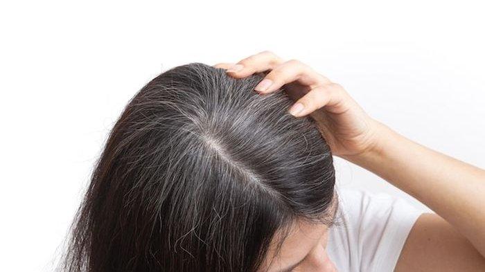 Ilustrasi wanita dengan masalah rambut beruban yang membuatnya kurang percaya diri.