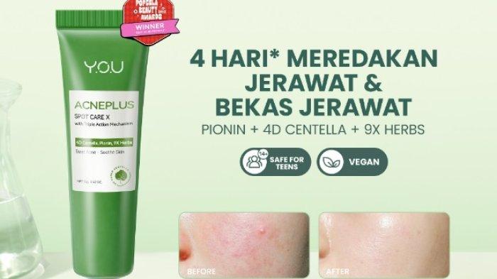 Y.O.U AcnePlus Spot Care Acne Treatment