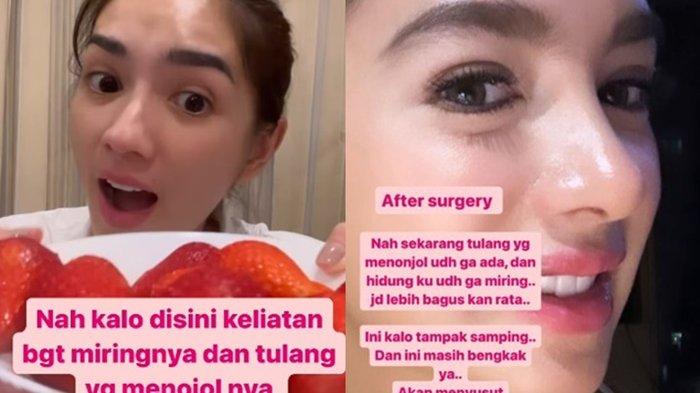 before-after Angel Karamoy