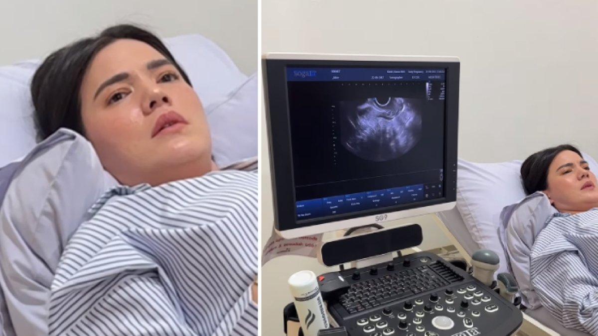 Alice Norin berobat ke Singapura untuk obati kanker sarkoma