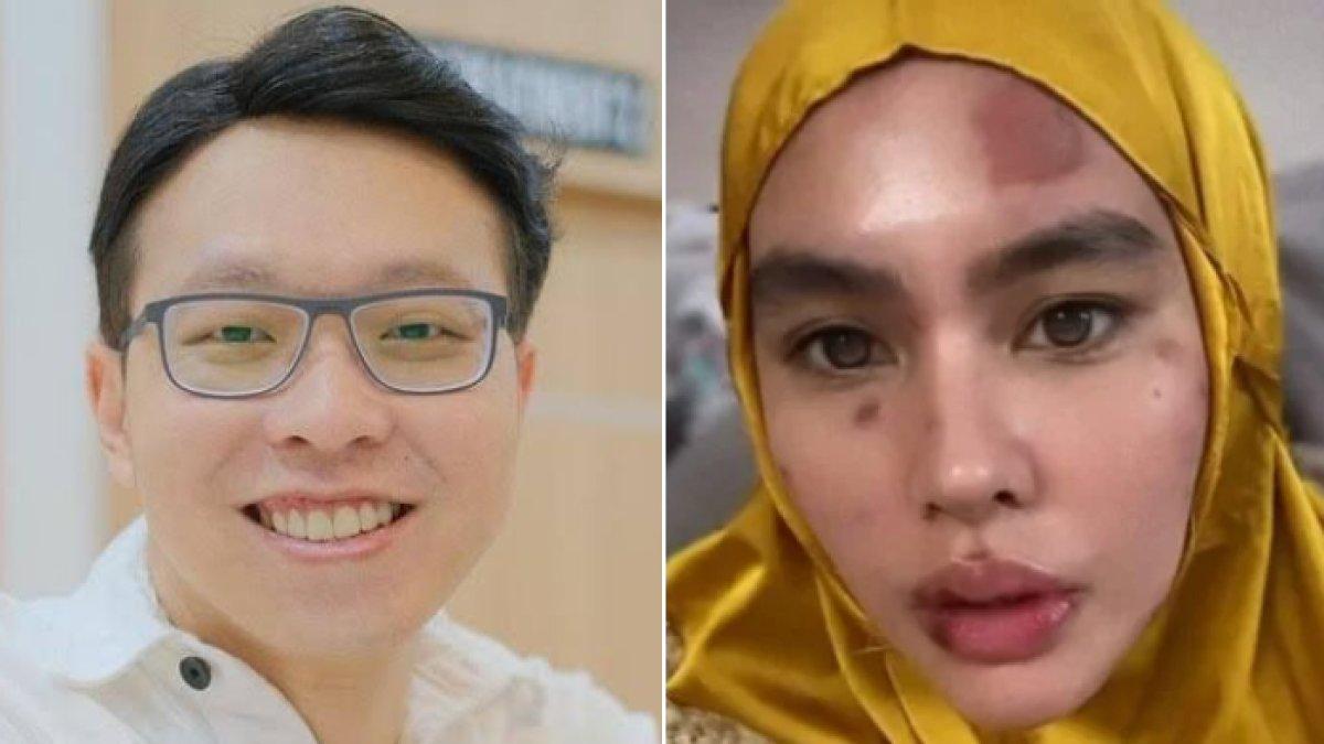 Richard Lee sempat ditahan oleh kepolisian buntut laporan Kartika Putri terkait dugaan ilegal akses.