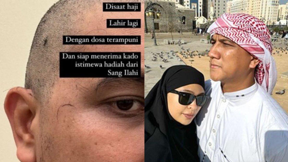 Arda Naff pangkas habis rambutnya