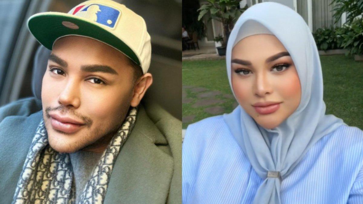 Aurel dibilang mirip Igun