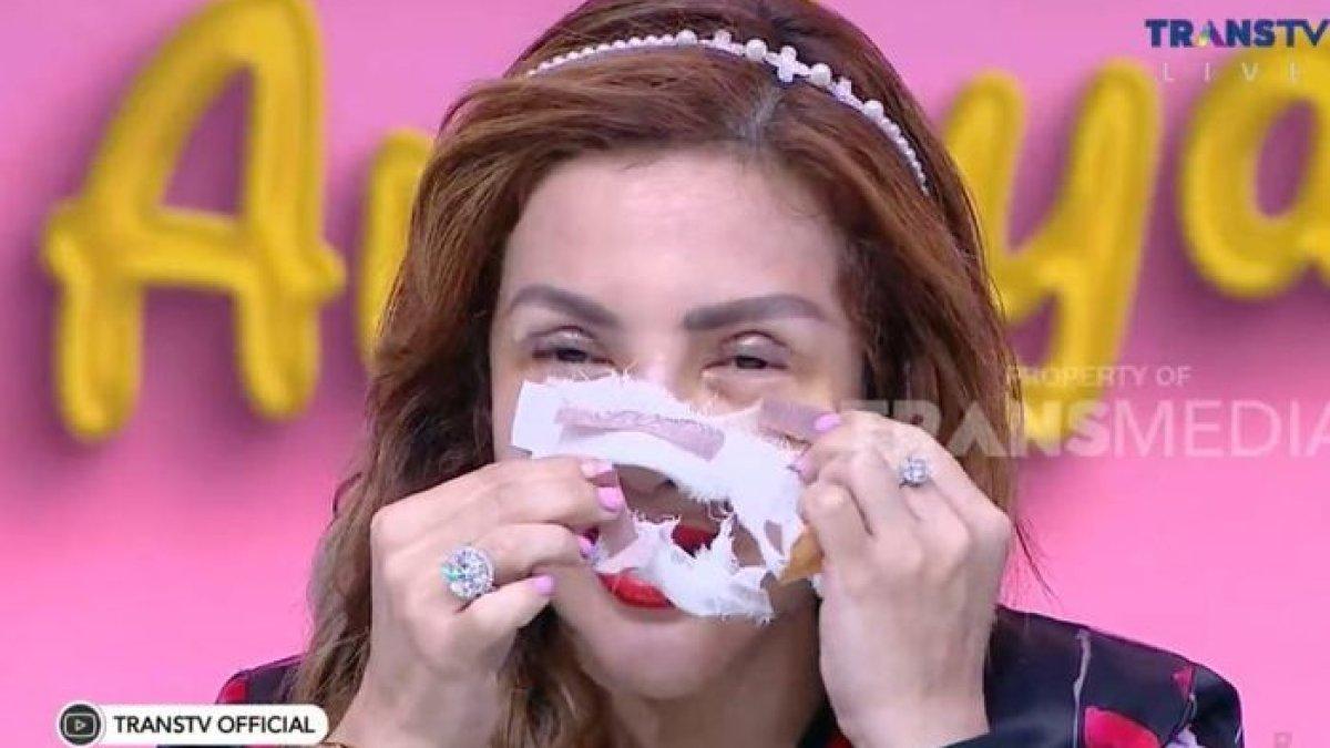 Barbie Kumalasari membuka perban yang menutupi area wajahnya.