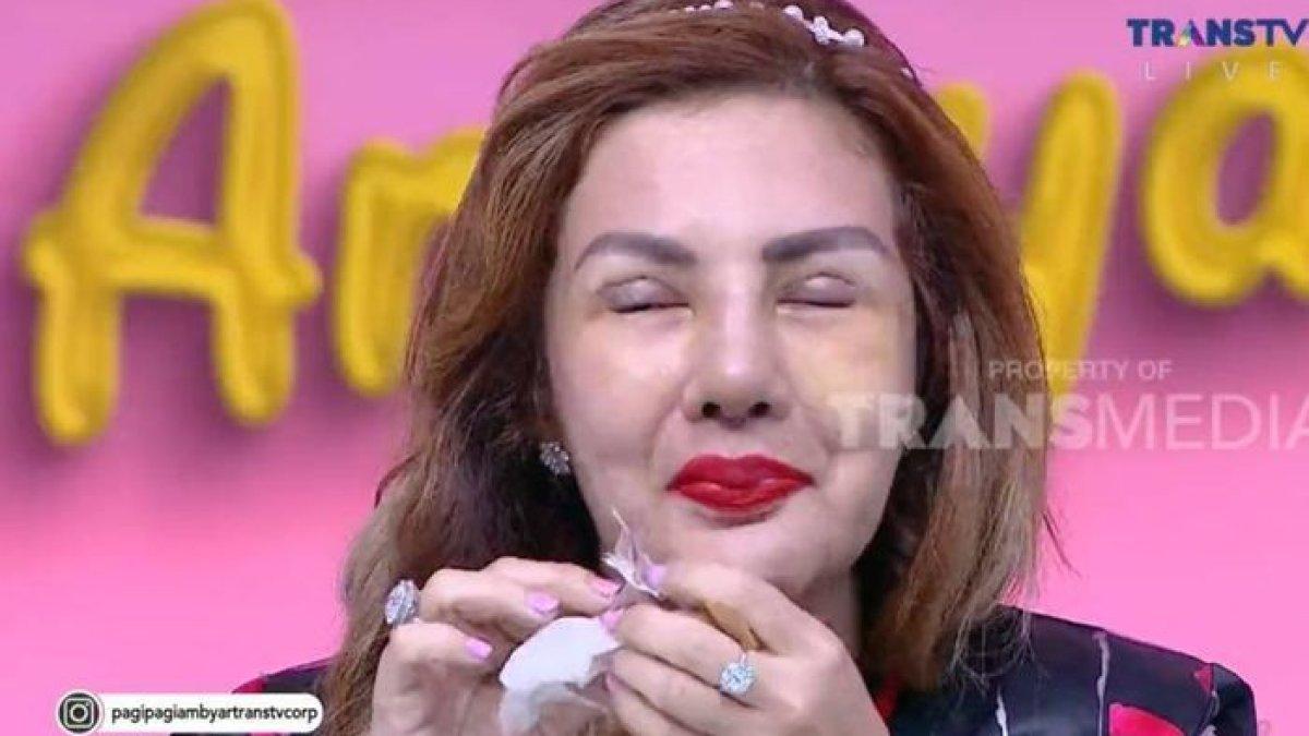 Barbie Kumalasari memperlihatkan bentuk hidung dan kelopak matanya yang baru.