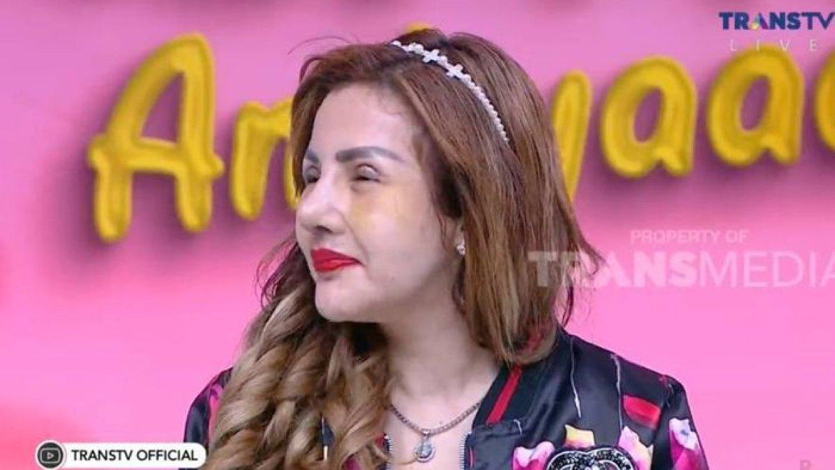 Barbie Kumalasari memperlihatkan bentuk hidungnya dari sisi samping.