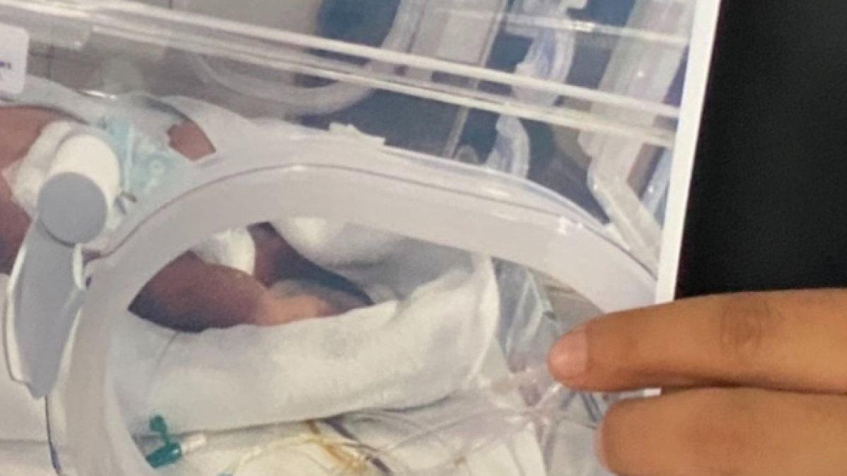 Bayi baru lahir di Jakut kritis, ibu curhat jadwal caesar sempat diganti