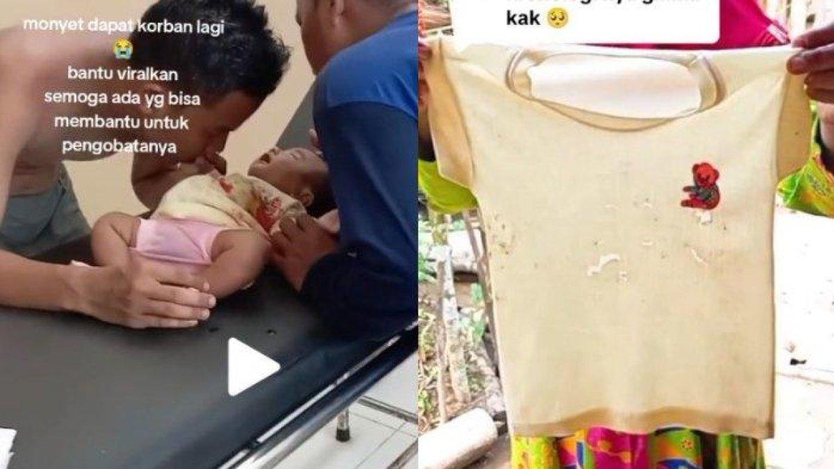 Bayi digigit monyet liar di Lebak, Banten kini jalani operasi