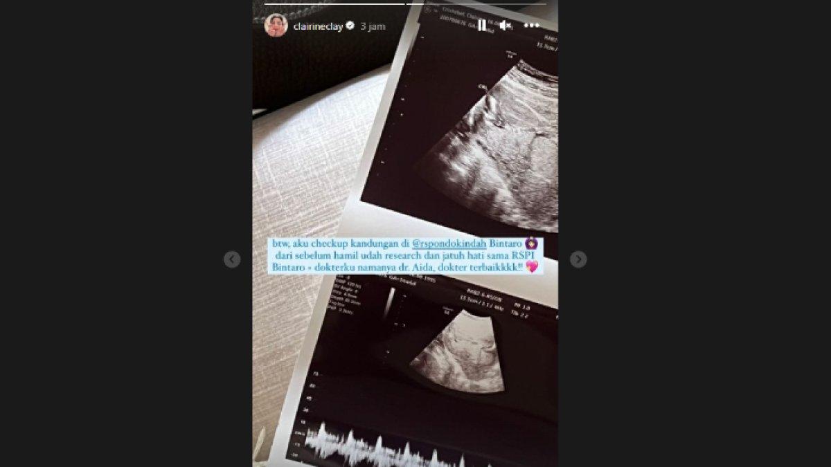 Clay mengaku biasanya check up kandungan di Rumah Sakit Pondok Indah Bintaro
