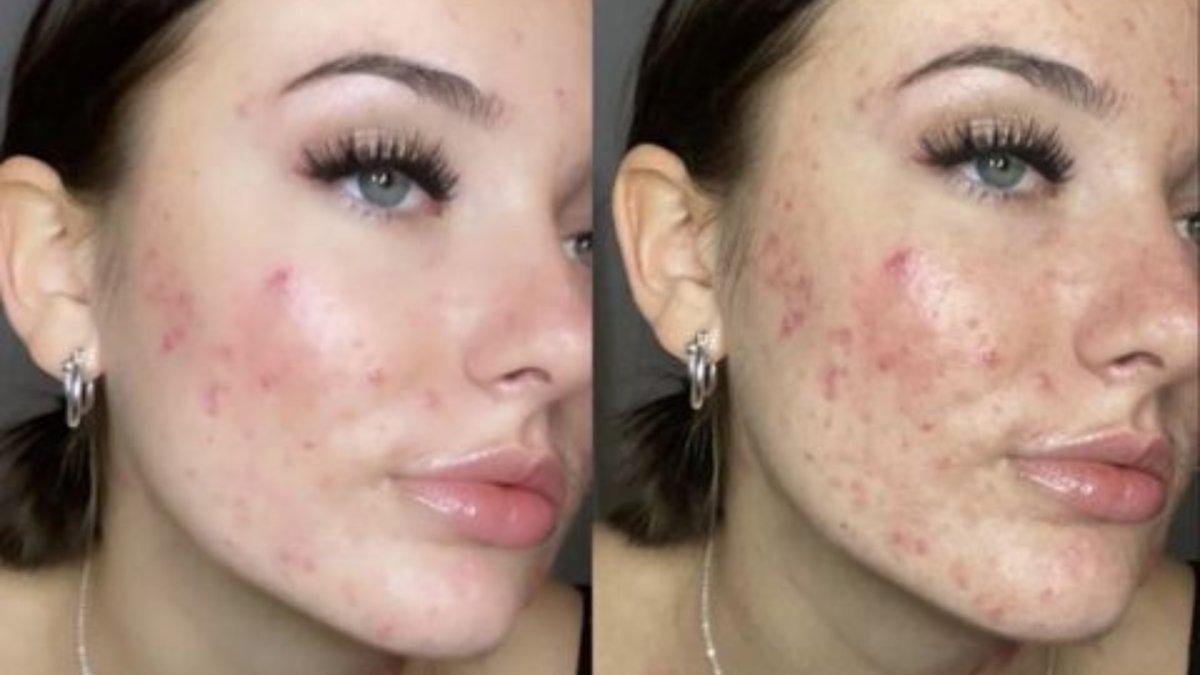 Courtney Jones bahkan mendapat julukan 'wajah pizza'