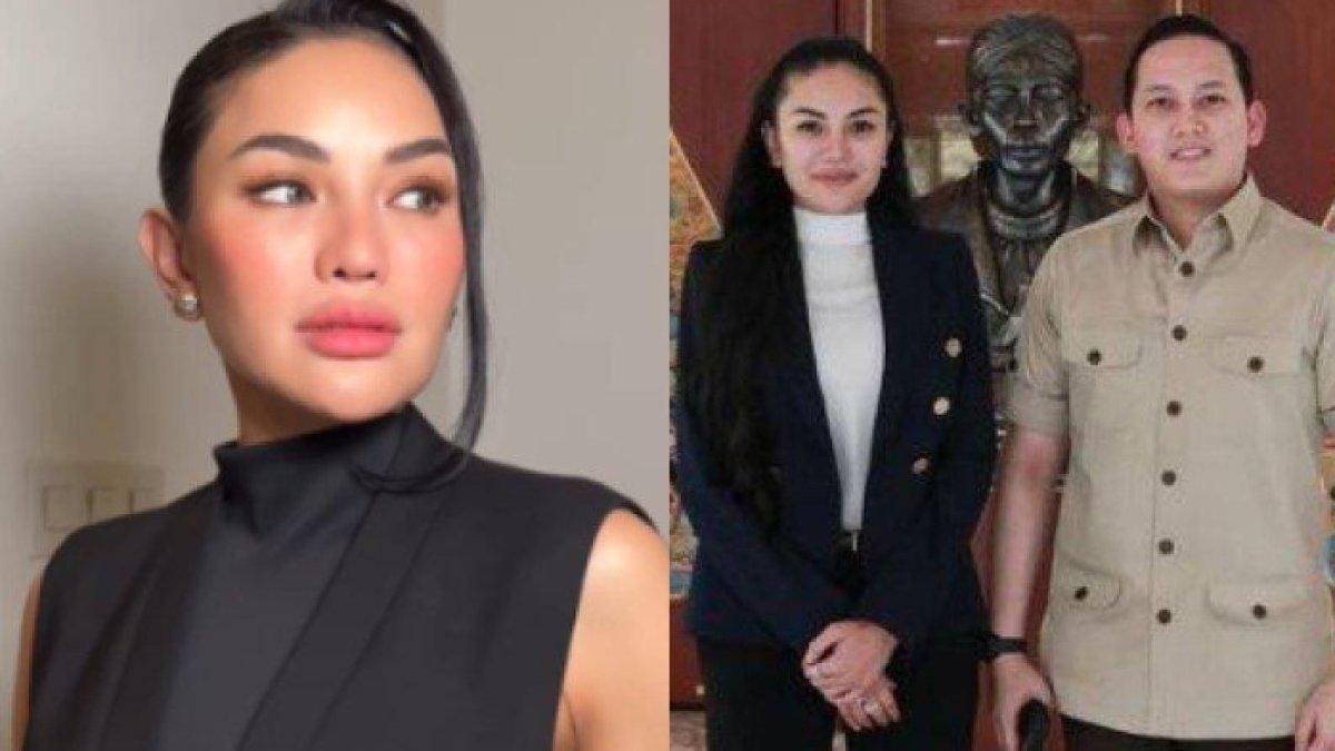 Nikita Mirzani Alami Penganiayaan dari Rizky Irmansyah