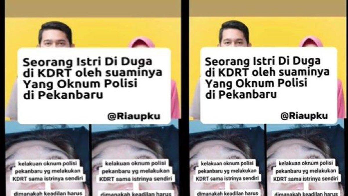 Curhat istri polisi di Pekanbaru, dianiaya suaminya hingga keguguran