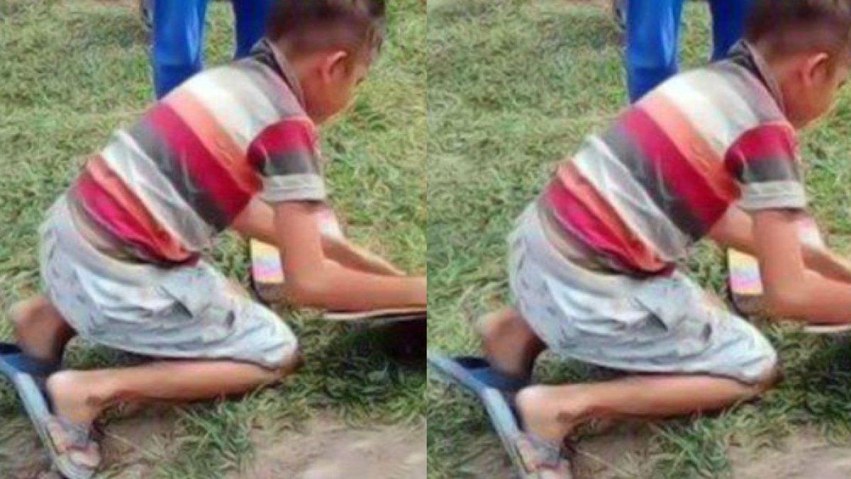 Detik-detik bocah dibully temannya usai sadar dari koma