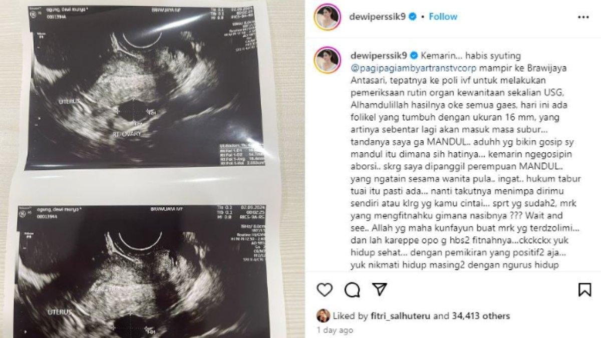 Dewi Perssik ungkap ada folikel tumbuh, tanda dirinya tak mandul