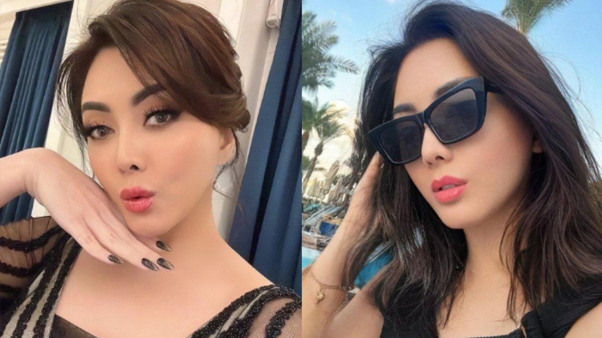 Dhena Devanka oplas di Korea karena dapat sponsor dari rumah sakit