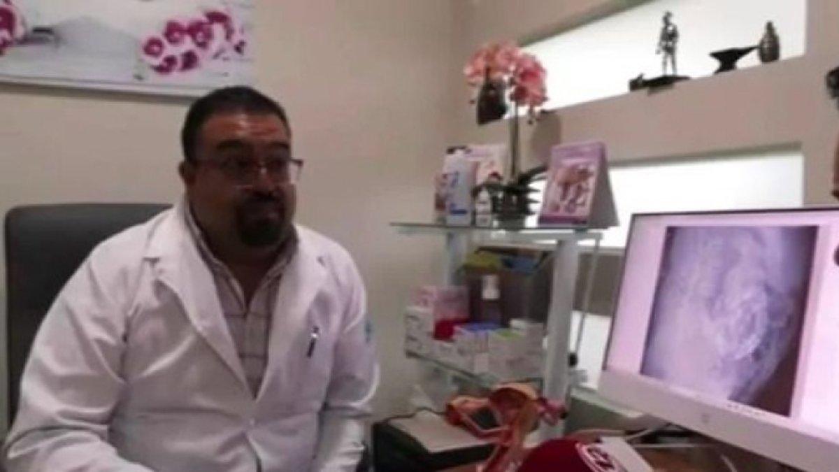 Dokter mengatakan nenek 84 tahun itu mengalami kehamilan batu