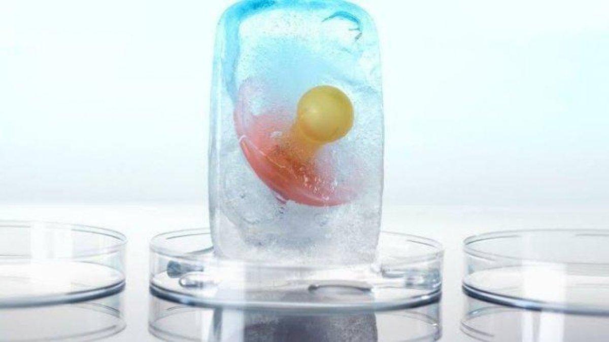 EGG FREEZING - Egg freezing menjadi perbincangan saat artis Luna Maya dipersunting oleh Maxime Bouttier. Sebelum menikah, Luna Maya diketahui sudah melakukan tindakan pembekuan sel telur atau egg freezing.