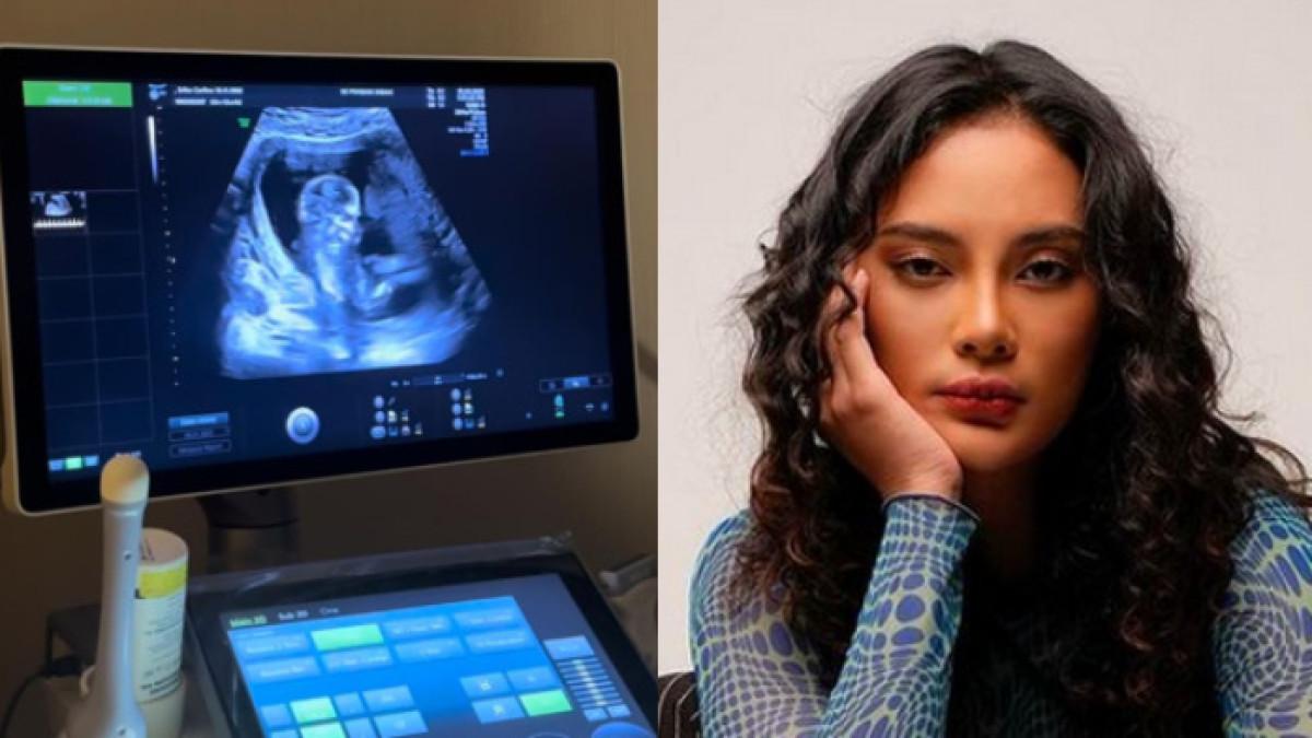 HAMILI BANYAK WANITA - Erika Carlina bukan satu-satunya korban, sang mantan rupanya hamili banyak wanita.