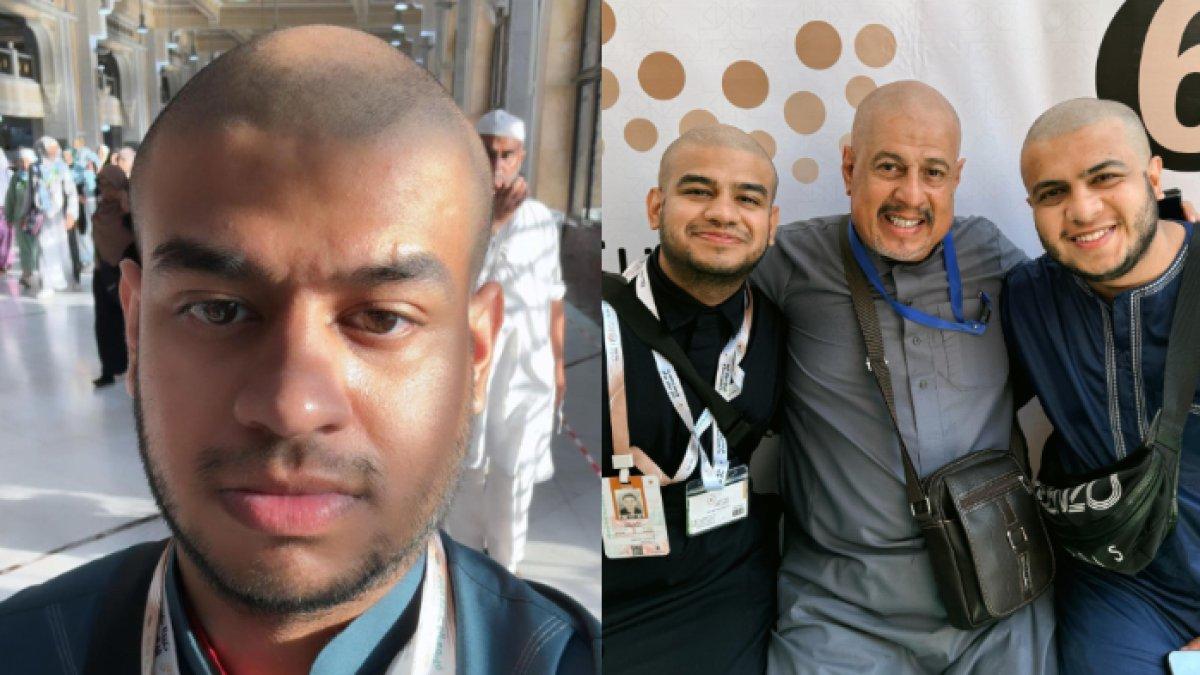 Fadil Jaidi mencukur habis rambut di kepalanya.
