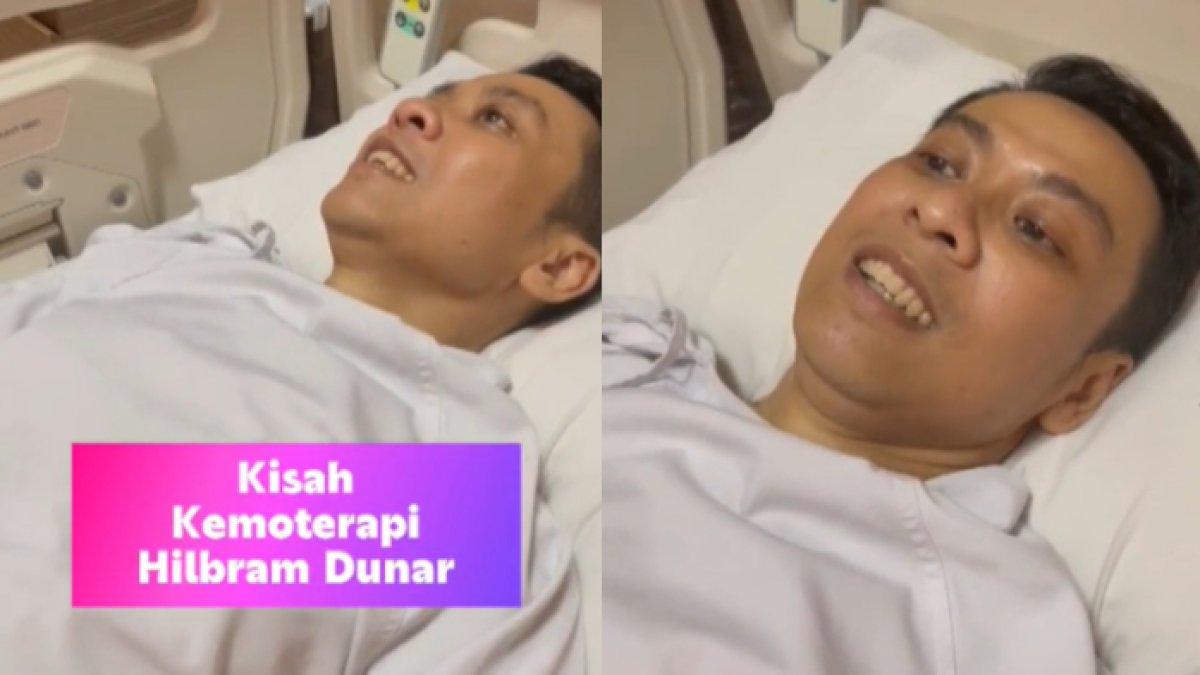Hilbram berbagi cerita soal kemoterapi.