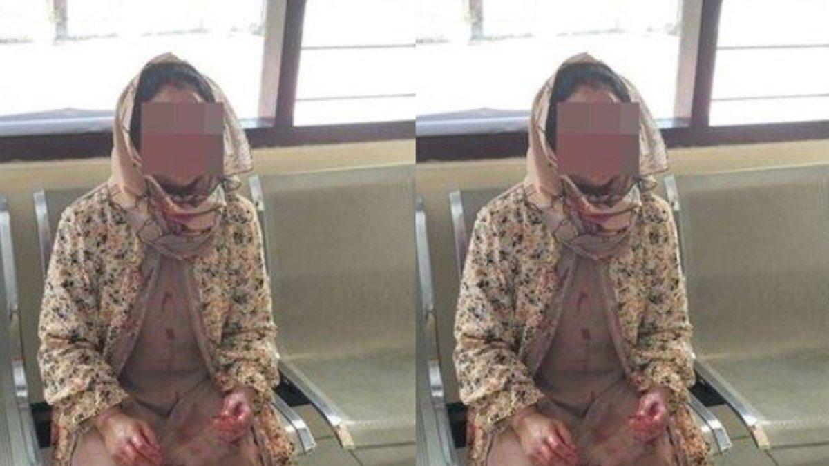 Ibu babak belur dianiaya anak gegara tak mampu beli motor RX King