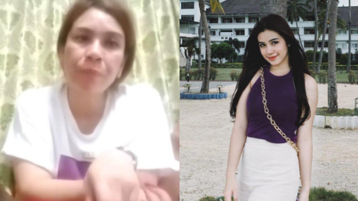 Ibunda Rinoa Aurora beberkan kondisi anaknya