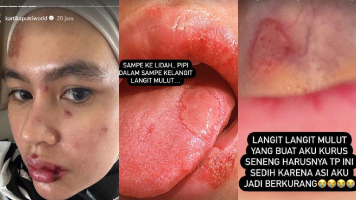 Kondisi Kartika Putri