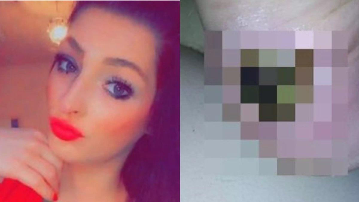 
Inilah kisah Charlie Beardshall-Moore, seorang wanita asal Hull, Yorkshire timur, Inggris. Kakinya terancam diamputasi setelah alami lecet. 