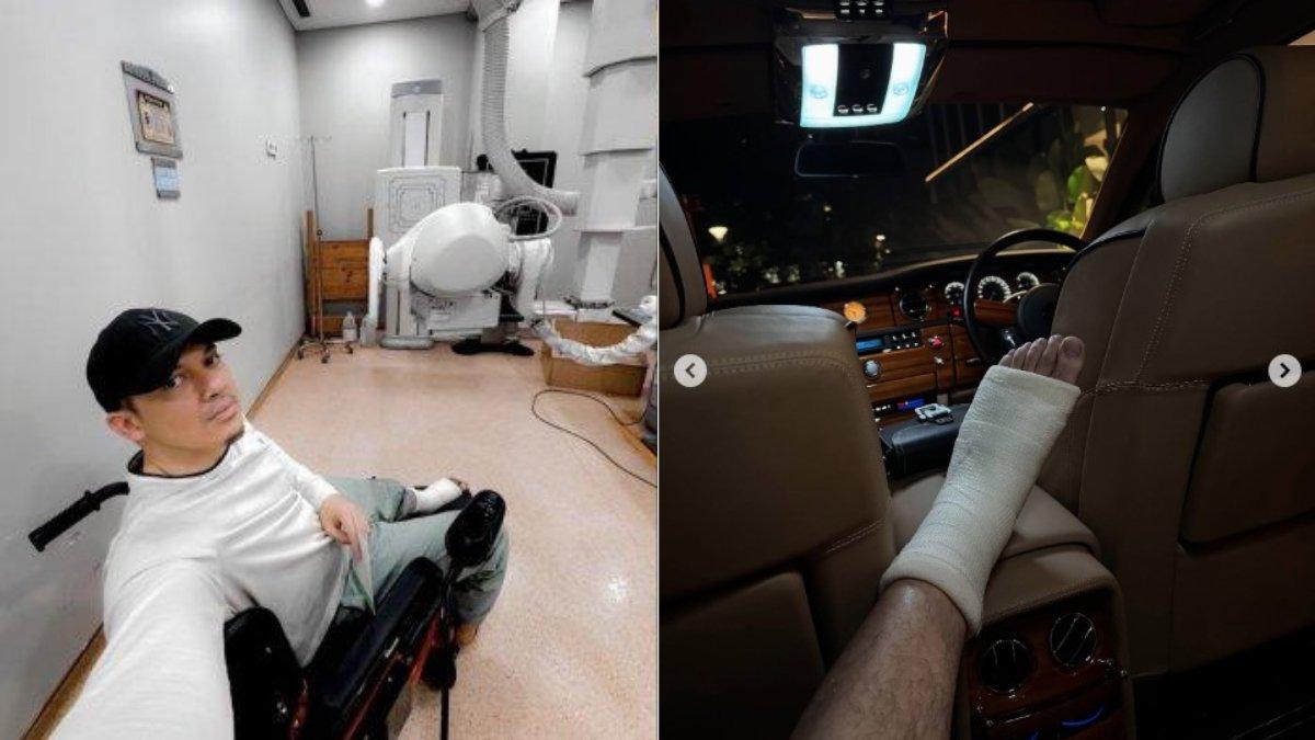 KONDISI IRWANSYAH - Meski kini tampak lebih sehat, Zaskia menjelaskan bahwa tulang kaki Irwansyah masih belum benar-benar menyatu.