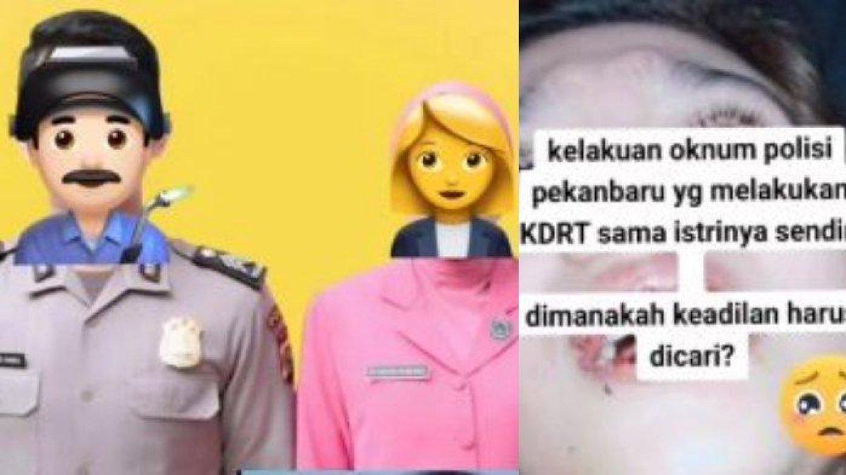 Istri polisi diduga di-KDRT suami hingga bibir pecah dan keguguran