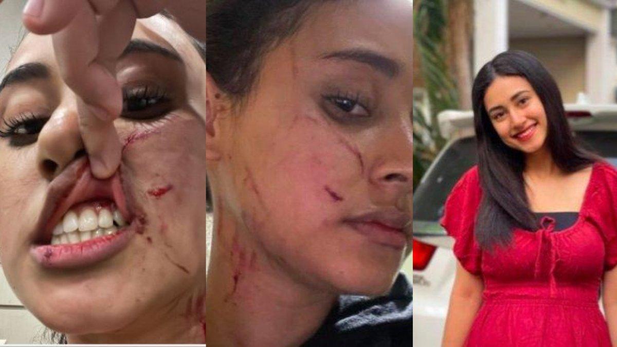 KISAH pilu selebgram Afifah Riyad dianiaya mantan pacar suami, wajah penuh dengan cakaran hingga bekas jahitan caesar memar.