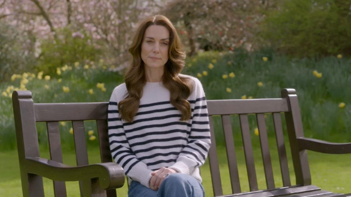 Kate Middleton sempat menjalani operasi di perut pada Januari 2024