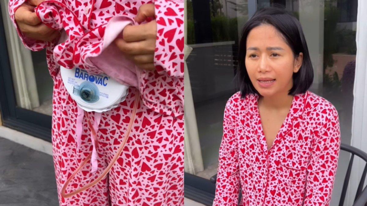 Inilah profil dan akun medsos Faria Nurhan YouTuber ini oprasi angkat implan payudara mengaku kapok 